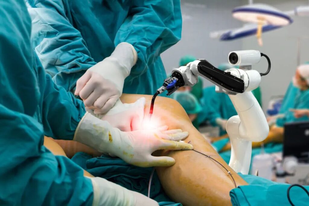 Revision Total Knee Joint Replacement Surgery in Ahmedabad